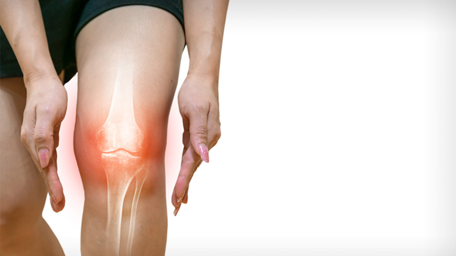 human leg showing osteoarthritis and  inflammation off knee joint with illustration of bone and red areas surrounding the knee